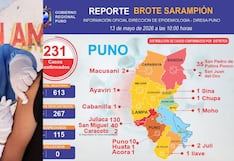 Región Puno reporta 231 casos de sarampión
