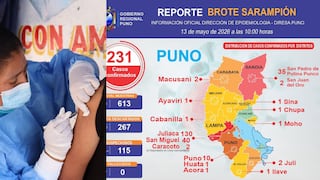Región Puno reporta 231 casos de sarampión