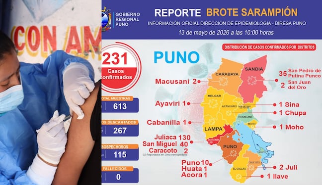 Región Puno reporta 231 casos de sarampión