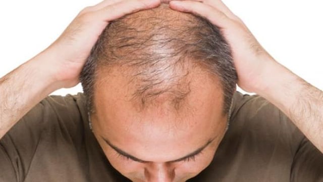 Pérdida de cabello: ¿Qué hacer para reducir su impacto?