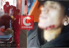 Pisco: hombre resultó herido en la mandíbula y antebrazo derecho tras una balacera