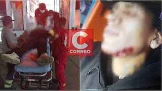 Pisco: hombre resultó herido en la mandíbula y antebrazo derecho tras una balacera