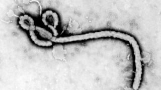 ¿Cuáles son los síntomas del ébola y cómo se transmite?