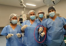 Piura: Un grupo de médicos salva la vida de una joven que se tragó un cepillo de dientes