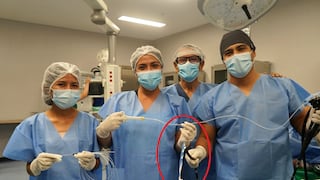 Piura: Un grupo de médicos salva la vida de una joven que se tragó un cepillo de dientes