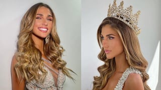 Miss Universo 2022: médico estético sugiere algunos ‘retoquitos’ para Alessia Rovegno (VIDEO)