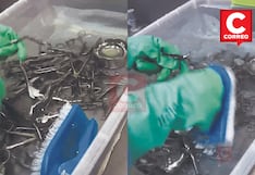 Riesgo sanitario en EsSalud, personal lava a mano material usado en cirugías