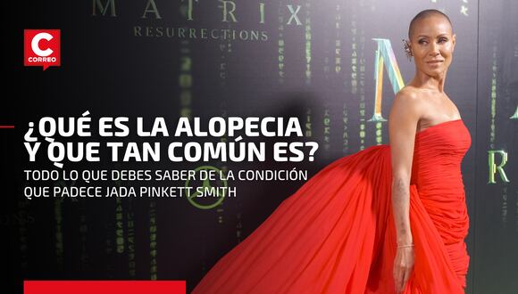 Alopecia: todo sobre la condición que padece la esposa de Will Smith