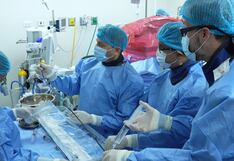 Un hito en Sudamérica: médicos peruanos colocan el marcapasos más pequeño del mundo a niña de 9 años