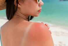 Primeros auxilios en verano: Cómo actuar ante picaduras, quemaduras solares y accidentes acuáticos