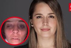 Yiddá sufre fuerte accidente en pleno rodaje y cancela su show: “Espero estar mejor” (VIDEO)