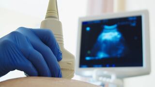 Cinco datos clave que debes conocer antes de congelar tus óvulos