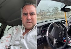 Campaña se estrena con violencia: Atentan contra el precandidato presidencial Rafael Belaunde Llosa