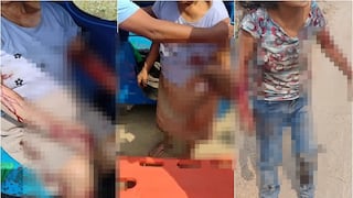 Chincha: tres perros rottweiler atacan a anciana de 73 años y casi la matan en Sunampe
