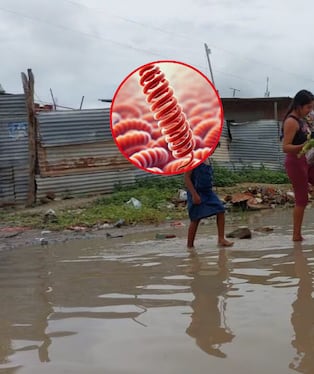 Condiciones sanitarias agravan la situación.