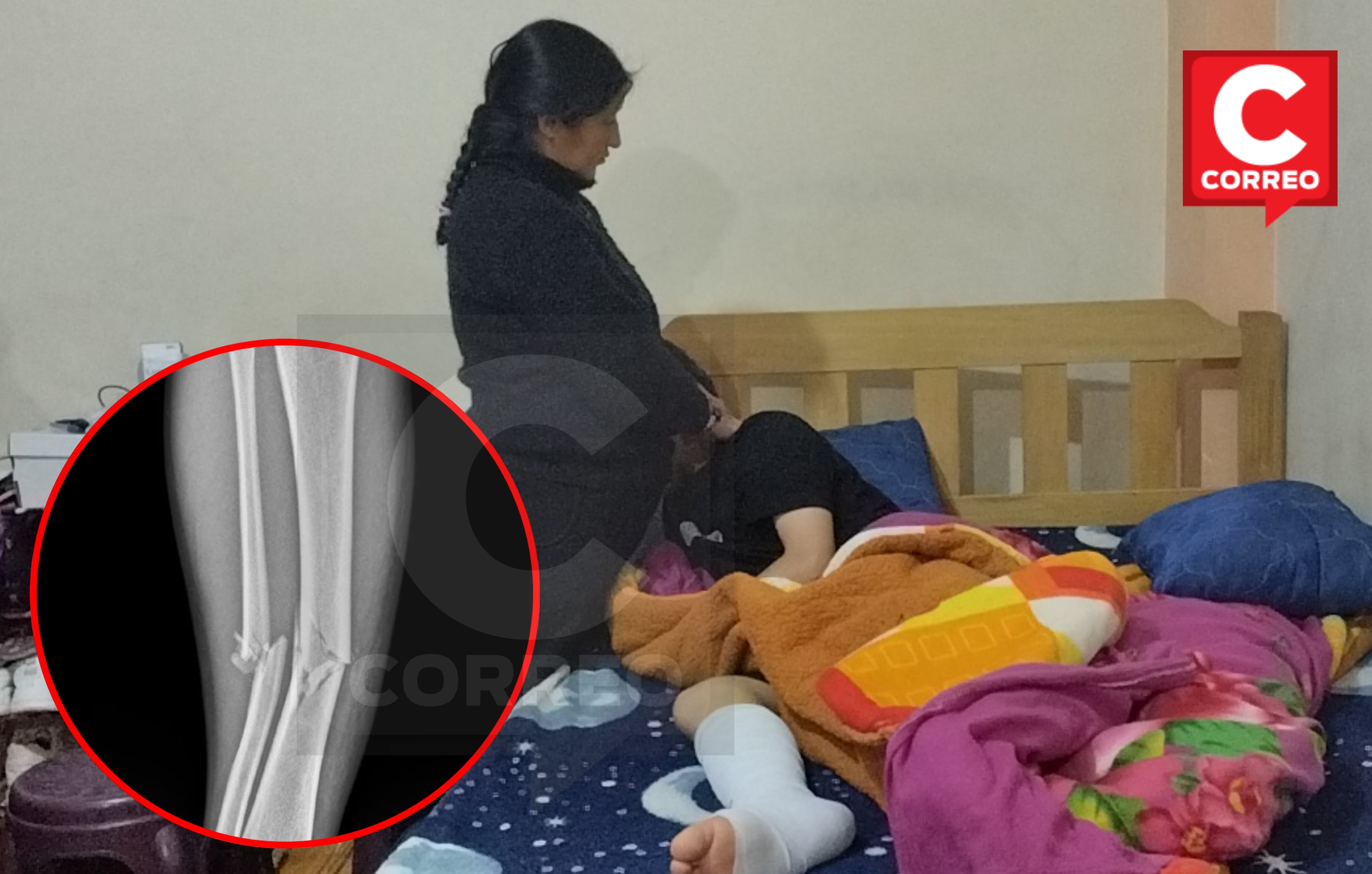 Patrullero atropella a atleta de 14 que llegó a Huancayo a rendir examen