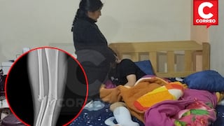 Huancayo: patrullero atropella a escolar atleta de 14 años y familia pide ayuda