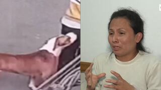 Madre y su hijo con autismo fueron atacados por perro pitbull, en El Agustino 