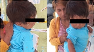 Ica: menor de dos años sufre brutal ataque de rottweiler en el distrito de Santiago