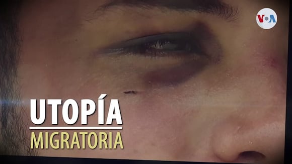 Utopía migratoria | “Me arrepiento de haber venido a EEUU”, dice inmigrante venezolana