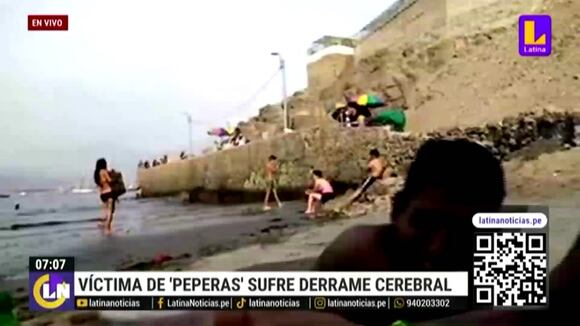Hombre sufre derrame cerebral tras ser victima de peperas