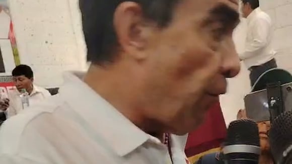 CORREO | Yonhy Lescano paralizaría el proyecto minero Tía María