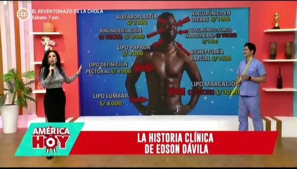 Cirujano echa a Giselo y revela cuánto invirtió en todos sus arreglitos