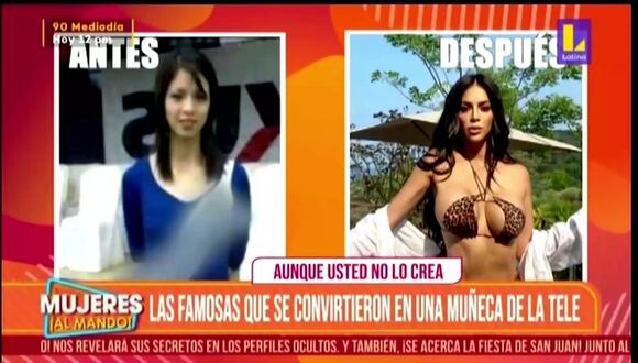 Presupuesto que habría gastado en operaciones Sheyla Rojas