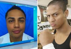Jonathan Maicelo luce nuevo rostro y cirujano opina: “Se ve un poco artificial” (VIDEO)