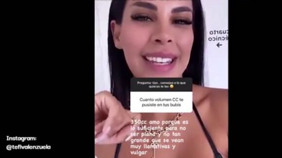 Tefi Valenzuela sobre cirugía (Instagram)