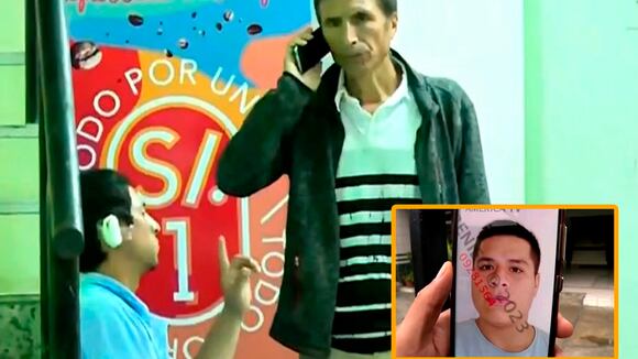 Chorrillos: Sujeto le arranca parte de la oreja a sereno de un mordisco