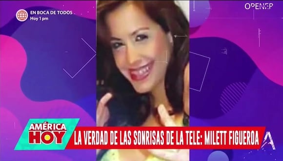 Milett Figueroa: antes y después de su sonrisa
