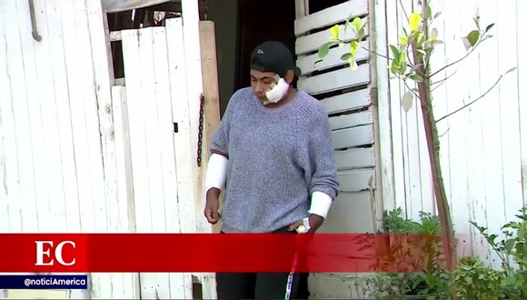 Joven quedó desfigurado tras ser atacado por perros pitbull