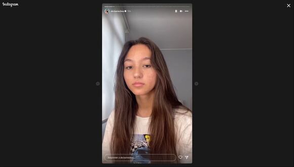 Alexia Barnechea agradece por apoyo que recibe tras hablar de acné