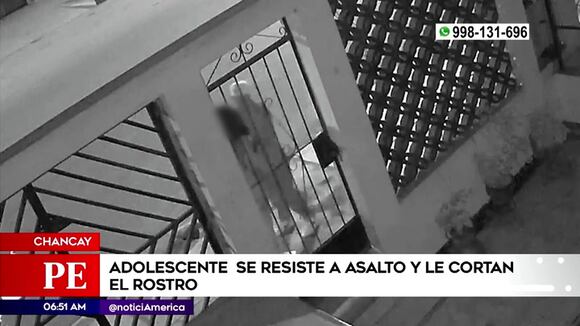 Chancay: cortan rostro a joven tras resistirse a robo