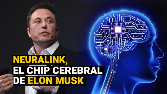 Neuralink: ¿Cómo funciona el chip cerebral desarrollado por la empresa de Elon Musk?