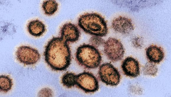 Imagen tomada con un microscopio electrónico de transmisión, muestra al SARS-CoV-2, el virus que causa COVID-19, emergiendo de la superficie de las células cultivadas en un laboratorio. Los picos en el borde exterior de las partículas del virus dan a los coronavirus su nombre, en forma de corona. (Foto: AFP/ Institutos Nacionales de Salud)