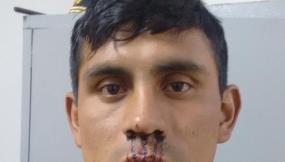 ​Sujeto ataca a policía en distrito de Santiago