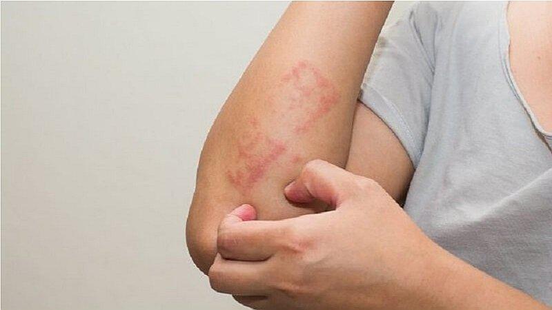 ¿Qué es la leucemia? Conoce los síntomas y cómo detectarlo