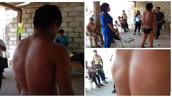 Satipo: Rondas campesinas castigan a ladrón golpeándolo con planta espinosa (VIDEO)