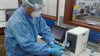 Logran reducir a tres horas el tiempo para resultados de pruebas moleculares de COVID-19 en Cusco 