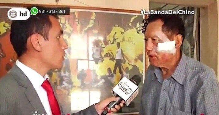 La Victoria: anciano sufre brutal ataque y le roban S/ 50 mil (VIDEO)