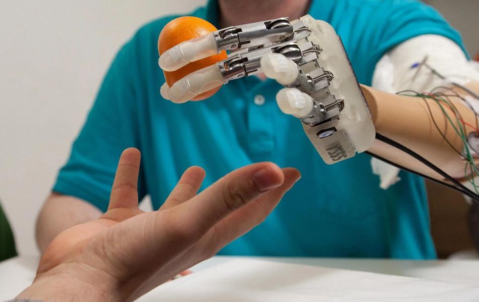 EE.UU.: Desarrollan prótesis que brinda sentido del tacto