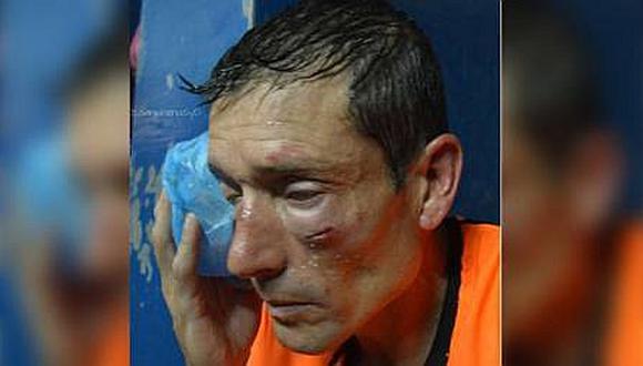 Argentina: Esta es la brutal agresión que sufrió un árbitro tras no cobrar un penal (VÍDEO)