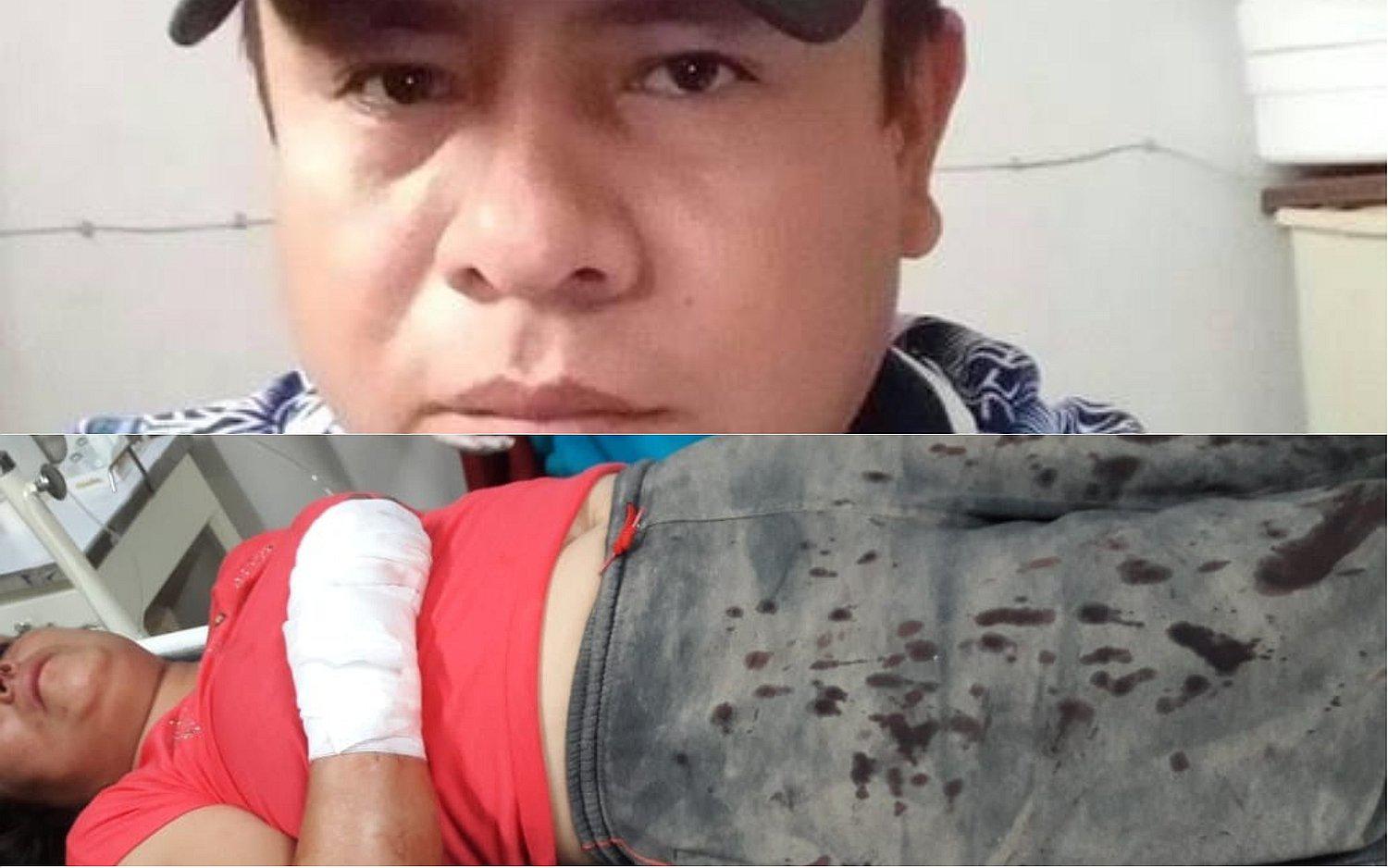 Obrero golpea y acuchilla a su esposa en el distrito de Tumán (VIDEO)