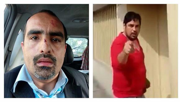 Periodista Fernando Llanos fue golpeado por sujetos que realizaban obra informal en Surquillo (VIDEO)