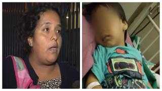 Mujer denunció que su hijo no recibió atención al sufrir accidente en Estación Caja de Agua (VIDEO)