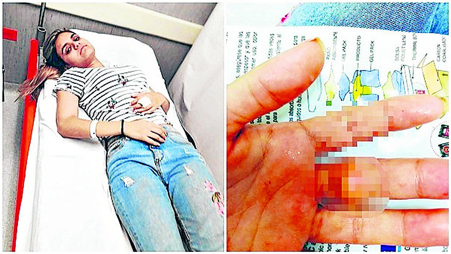 Joven sufre descarga eléctrica, pero UPN dice que fue un golpe 