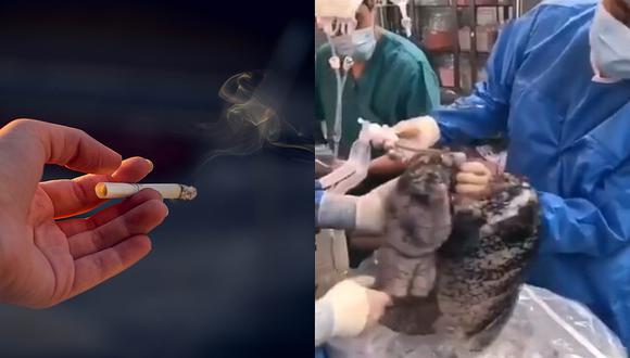 Fumador crónico donó sus pulmones y médico los rechaza por su terrible estado (VIDEO)