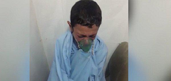 ​¿Voy a morir, señorita? El desgarrador grito de un menor sirio que conmueve al mundo